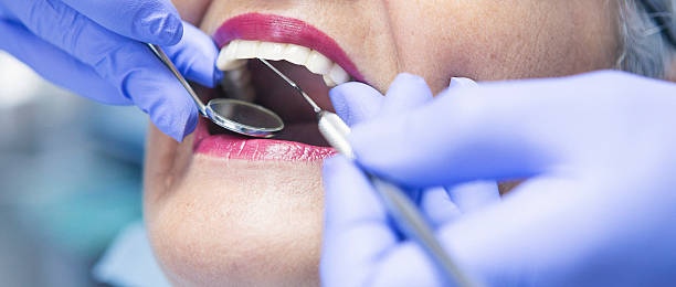 Best Dental Abscess Treatment in Mount Vernon, NY